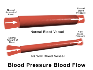 Trainingsadaptaties-bloeddruk